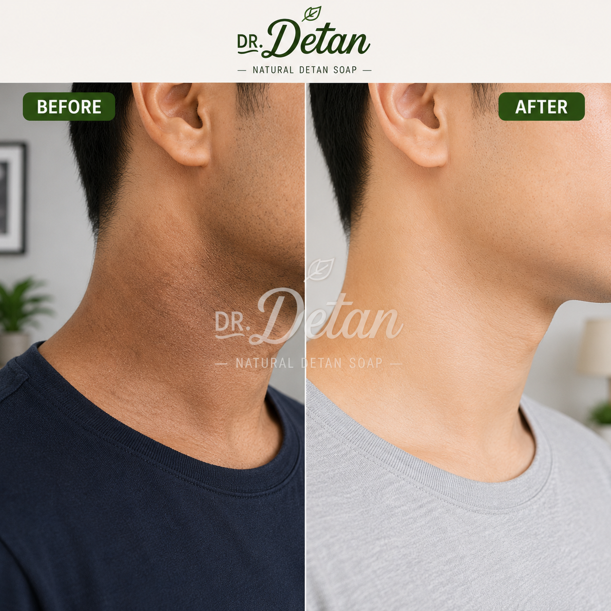 Dr. Detan Brightening Soap (Pack of 3)